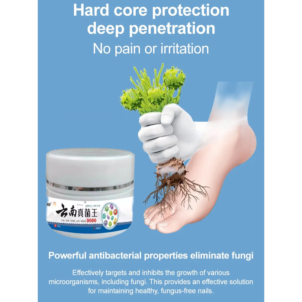 【Visible Results in 7 Days】Fungal King Nail & Foot Care Cream - Fungal Nail Treatment/Foot Care Crea