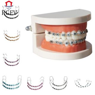 RGFV 1 Cặp Trang Trí Răng Tạm Thời, Với Dây Kim Loại Chân Đế Giả Dây Buộc Chỉnh Nha, Chất Liệu Nha Khoa Niềng Răng Nhiều Màu Sắc Trang Trí Nha Khoa Chân Đế Kim Loại Răng