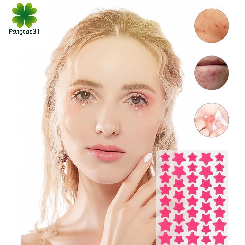 Miếng dán che khuyết điểm dạng star heart giúp giảm mụn với nhiều màu sắc - Peg 200/400