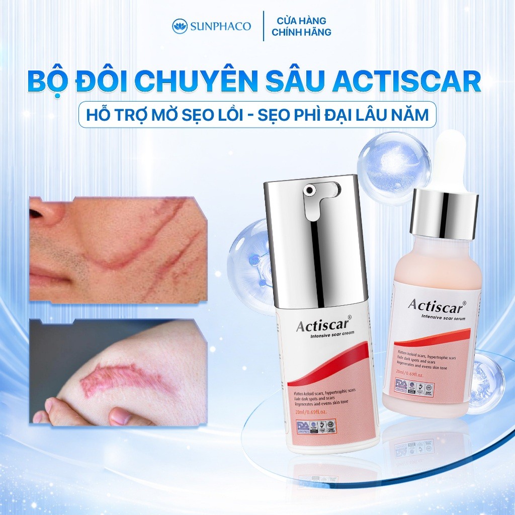 Combo Kem Và Serum Mờ Sẹo Chuyên Sâu Actiscar Giúp Làm Mờ Sẹo Lồi, Sẹo Phì Đại, Sẹo Thâm Lâu Năm