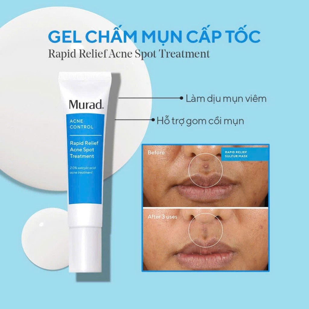 [Đại lý chính hãng] Gel chấm mụn Murad Rapid Relief Acne Treatment 15ml