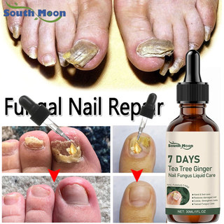 Serum Nấm Móng Tay Chân Khóe Móng, Hết Nấm Bọng Móng, Sưng Khóe, Chăm Sóc Móng Nhanh Dài Bóng Khỏe Tràm Trà & Gừng 7DAYS