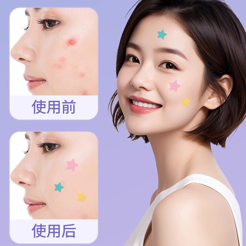 Sẵn sàng - Heines Heino 40 miếng băng keo nước hồng cho mụn trứng cá