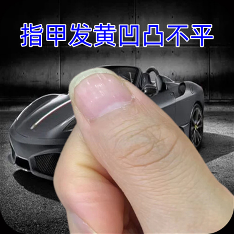 Spot Goods#Nails have vertical lines, the nail surface is uneven, nail care and repair cream