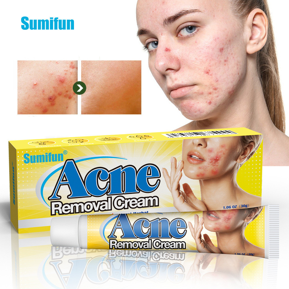 Sumifun Cream Acne Acne Cleaning Cream Acne Marks Care Health Cream K10135 Cream 2026 / 03.11