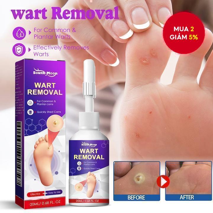 South Moon Corn Removal Foot Liquid Corn Remover Calluses Plantar Warts Thorn Pain Relief - 27993498
