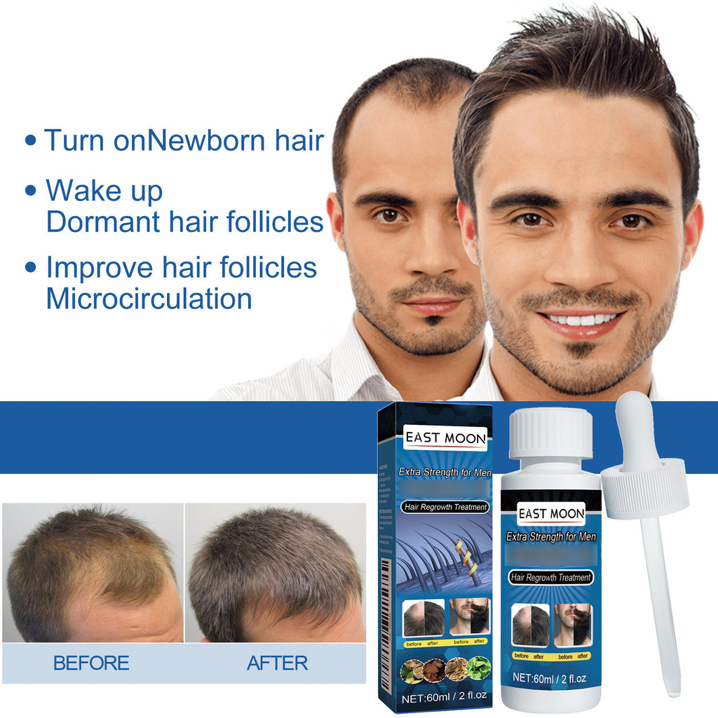 baoluan#East Moon Men's Hair Care Solution Men's Hair and Beard Repair Nourishing Scalp Care Solutio