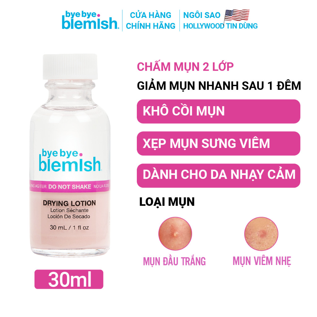 Chấm Mụn Giảm Mụn Nhanh Sau 1 Đêm Dành Cho Mụn Trắng, Sưng Đỏ, Da Nhạy Cảm Bye Bye Blemish Original Drying Lotion 30ml