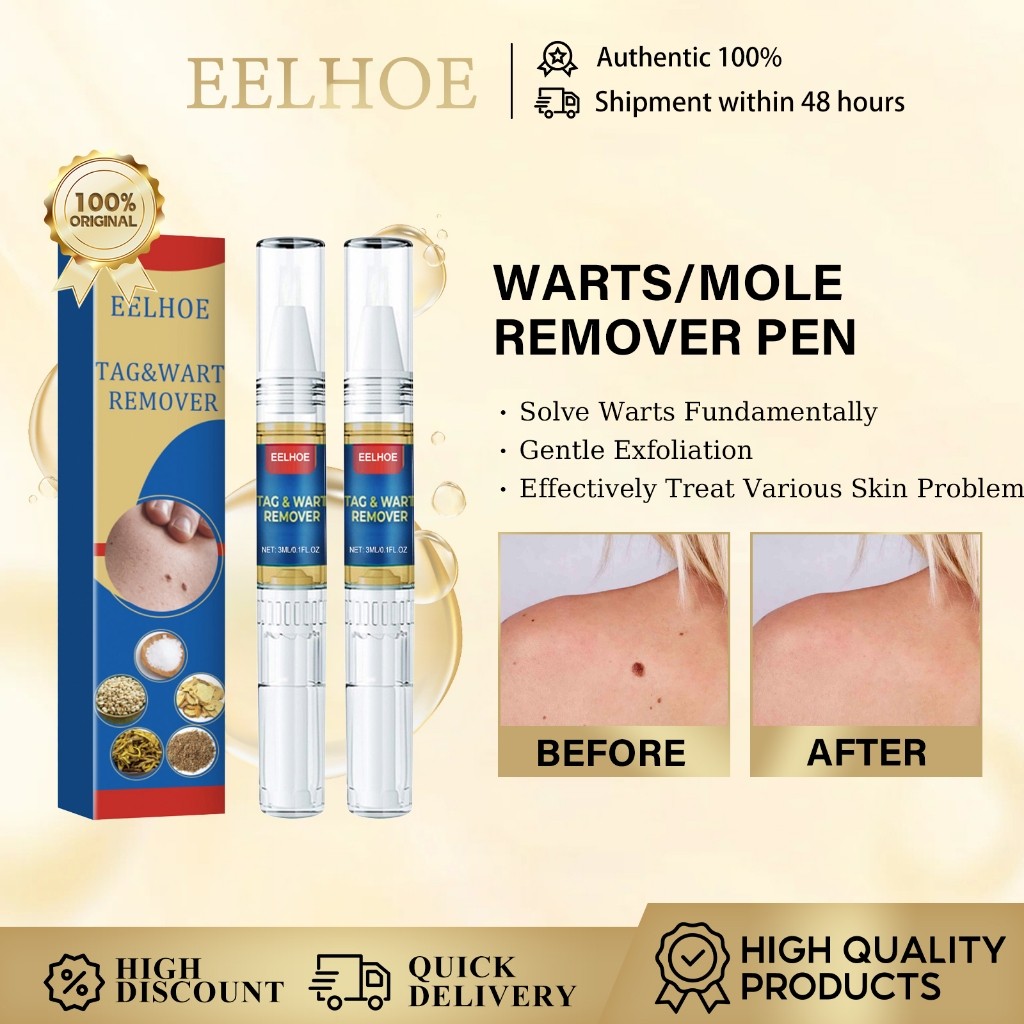 Eelhoe Warts Remover Pen Mole Remover Pen Skin Tag Remover Pen Chăm sóc da Sửa chữa mụn cóc lỏng Mag