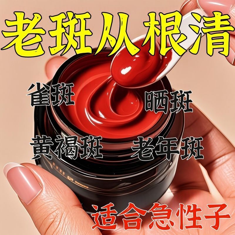 Hot Sale#[Hong Kong Domestic Product]Melasma, age spots, back of hand spots, freckles, pigmentation 