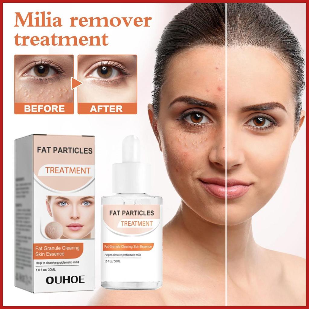 Skin Pimple Remover 30ml Zit Remover Liquid Fast-Activing Toner Spot Corrector Kết quả lâu dài cho n