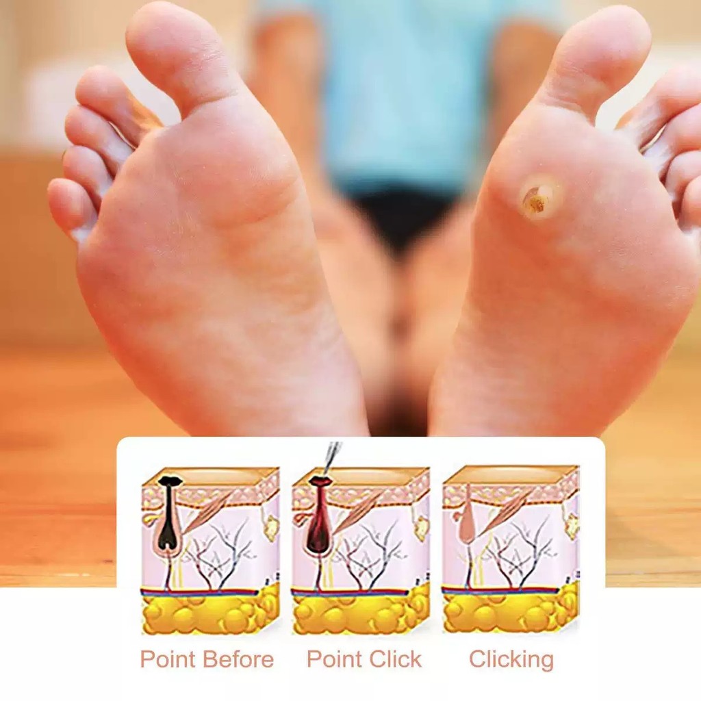 Hàng sẵn có Giao hàng nhanh Kem chăm sóc da ngô bán chạy Lụa ngô liền mạch Eugene Flat Eugene Loại b