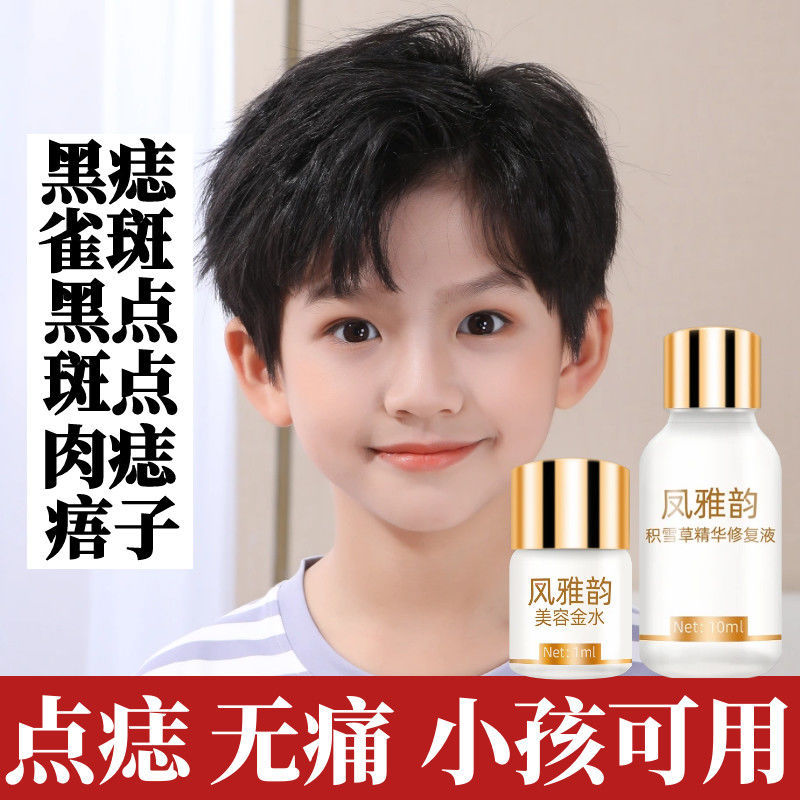 Hot Sale#[3578I'm here4Shipped within hours]Mole Removal Cream for Face Black Spots, Mole Removal, P