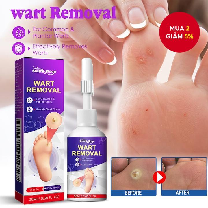 South Moon Corn Removal Foot Liquid Corn Remover Calluses Plantar Warts Thorn Pain Relief - 27993498