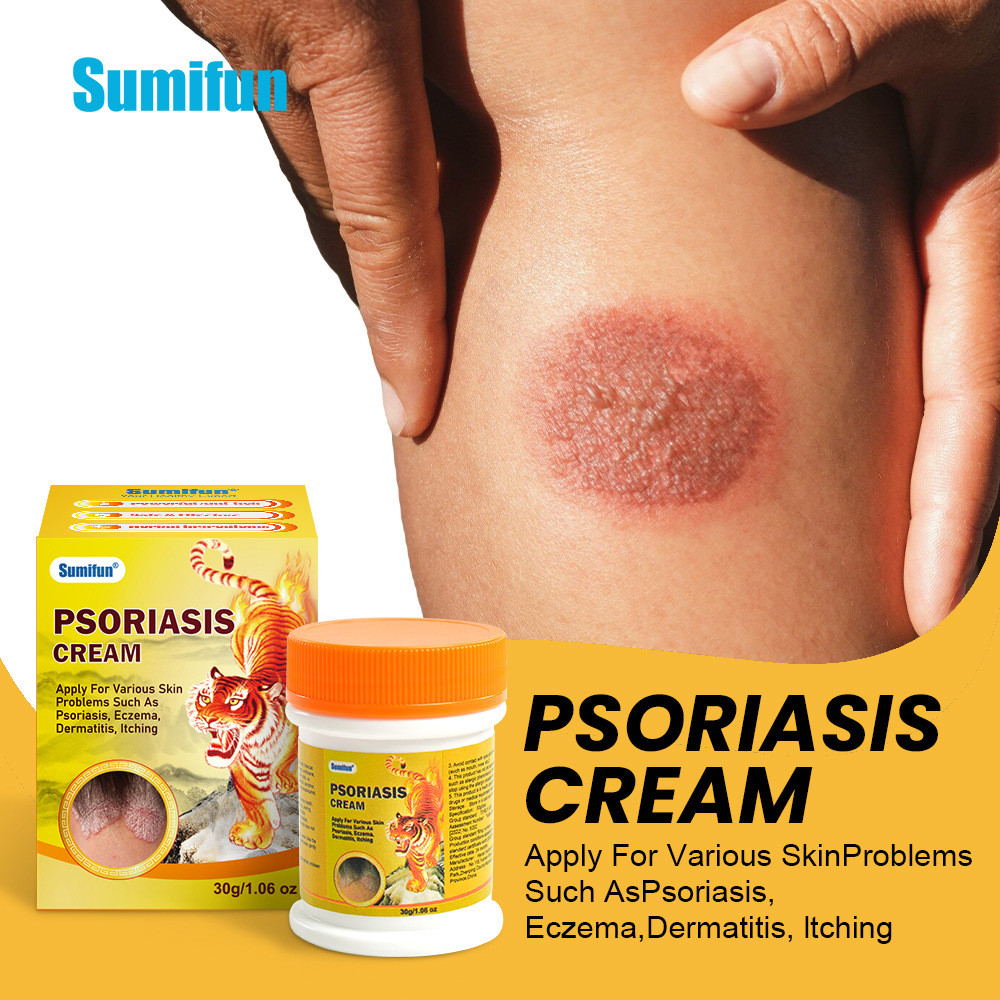 Kem trị vẩy nến hiệu quả - K20124WG