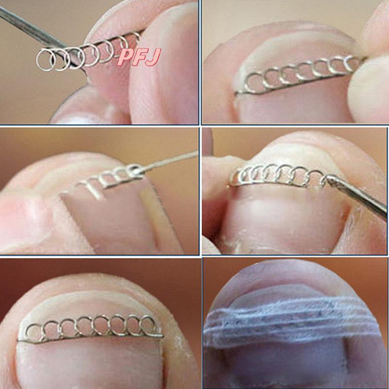 PFJ 12PCs Mũi mọc ngược Chỉnh sửa móng tay Dây Fixer Phục hồi móng chân Dụng cụ chăm sóc bàn chân Lo