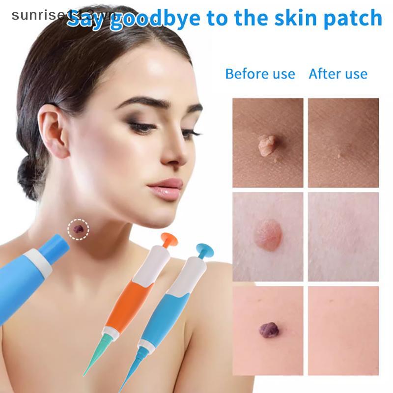 SR Beauty Auto Skin Tag Removal Kit 1-8mm Band Không đau Mole Wart Skin Tag Remover Pen Wart Dot Cor