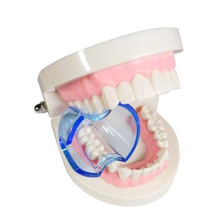 Dụng Cụ Mở Miệng Bên Trong Răng Miệng