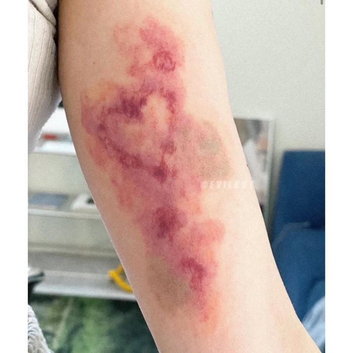Love Bruises Bệnh Thẩm Mỹ Màu Hình Xăm Miếng Dán Ins Có Thể Giặt Đẹp Cô Gái Cánh Tay Mô Phỏng Tranh 