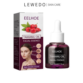 Tinh Dầu Dưỡng Da Mặt Oedo 20ml