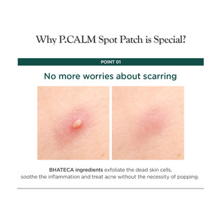 [P.CALM] set 2 hộp (78 miếng) Miếng dán mụn P.CALM All Day Clear Patch