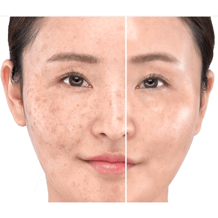 Active Marine Astaxanthin Capsule Serum 30ml