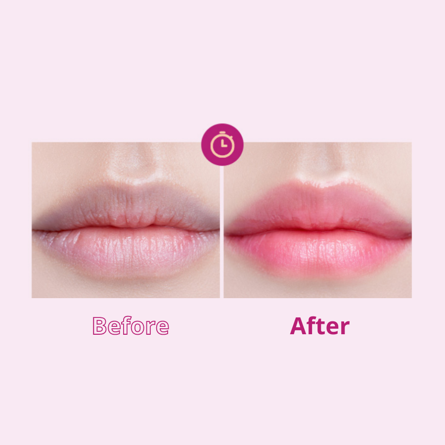 Dầu dưỡng môi thuần chay Vitamin C I Dew Care 3.5ml