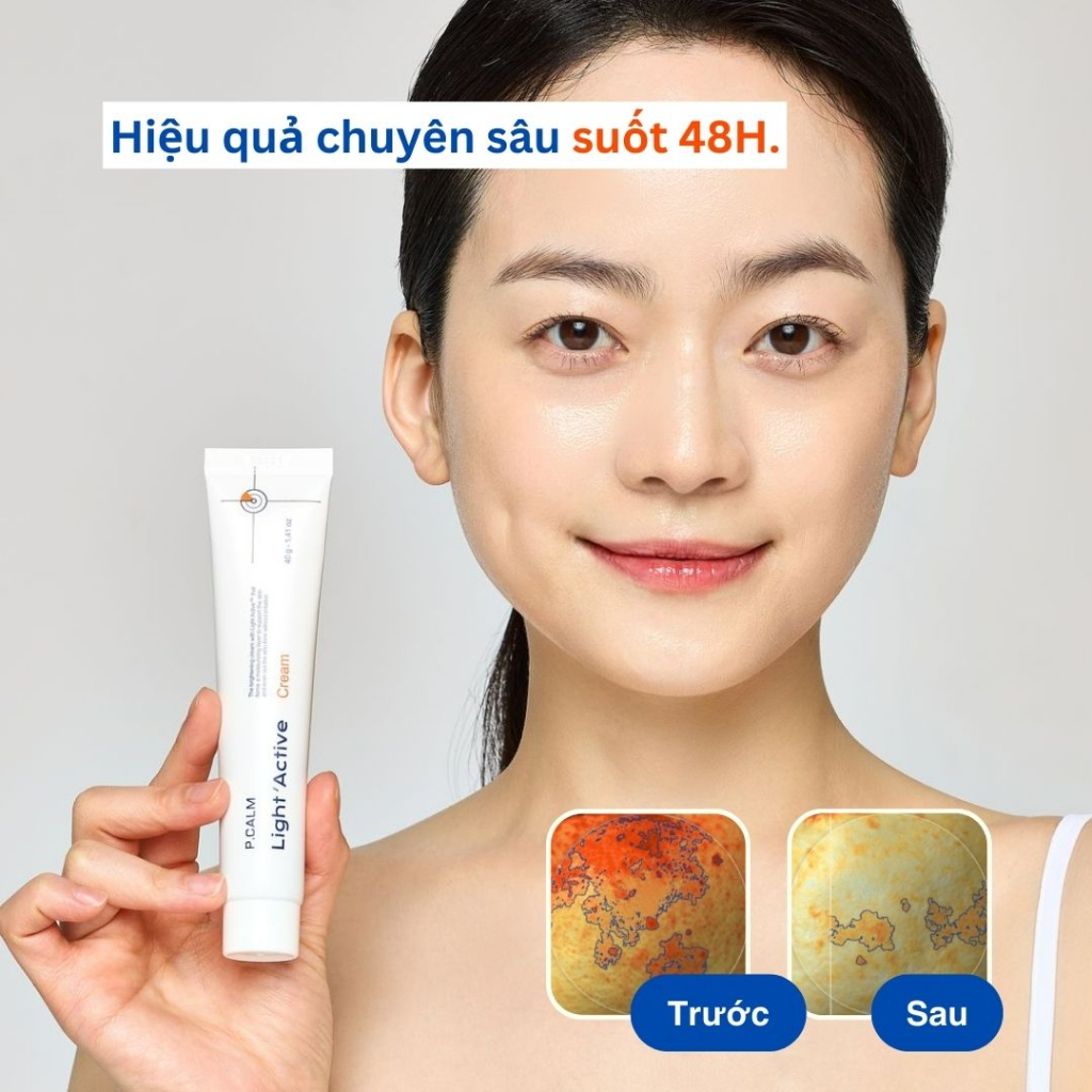 Kem dưỡng trắng sáng P.CALM Light Active Cream 40g