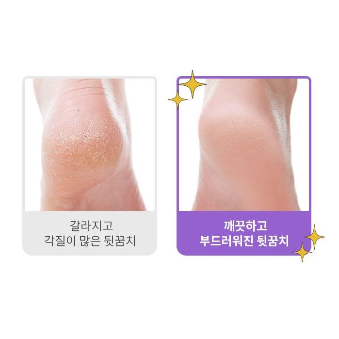 Hàn Quốc Vaseline C2Y ĐỘ ẨM SÂU CHÂN KEM/Kem Dưỡng Ẩm Sâu Chăm Sóc Da Chân 60ml