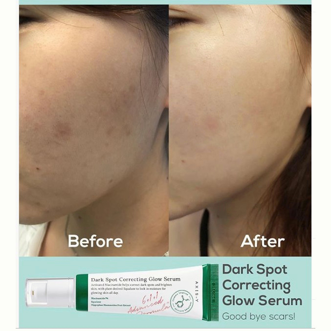 Tinh chất giảm béo axis-y dark spot correcting glow serum - hàng sẵn sàng