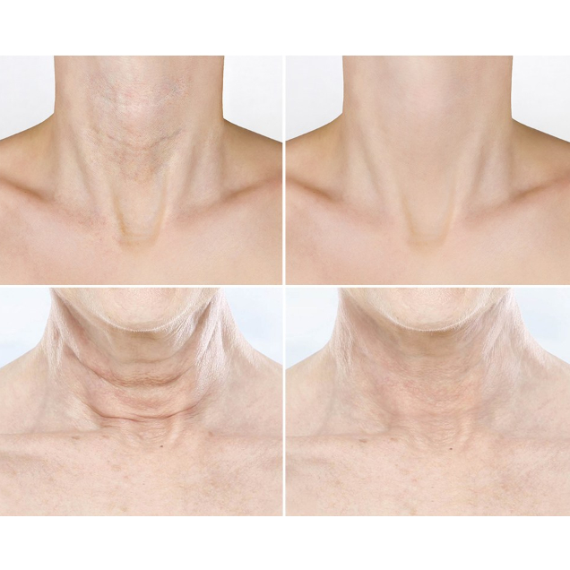 Kem dưỡng da vùng cổ ngừa lão hóa Vella Ultimate Age Killer Neck Cream 50ml