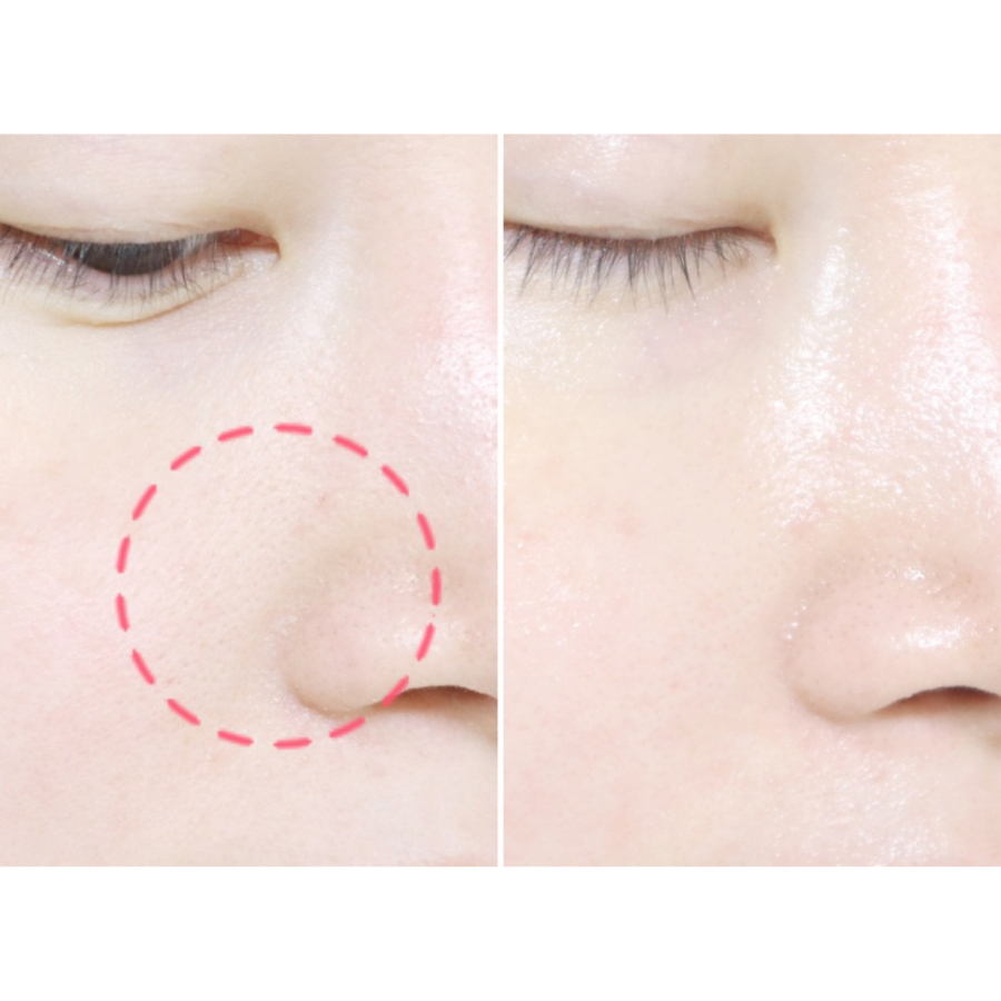 Kem dưỡng căng bóng ngừa lão hóa da Bio Heal BOH Probioderm Tightening Collagen Cream 50ml