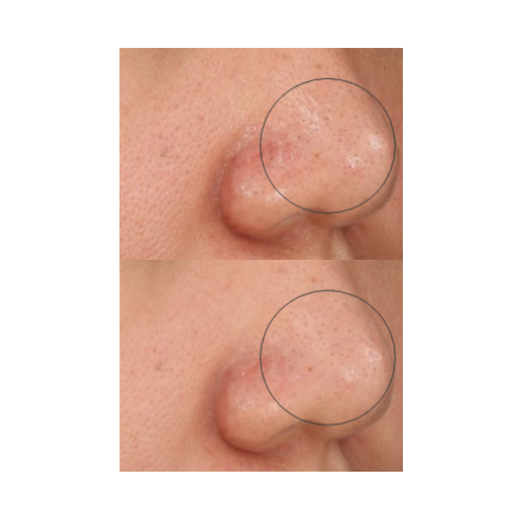 Mặt Nạ Đất Sét Núi Lửa INNISFREE 100ml