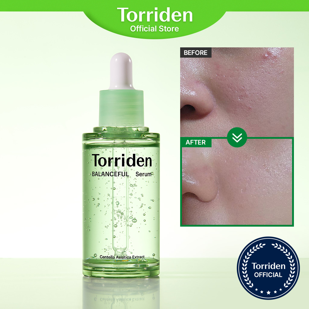 Serum TORRIDEN Balanceful chiết xuất rau má cải thiện tình trạng bã nhờn tẩy tế bào chết chăm sóc làn da 10ml/ 50ml