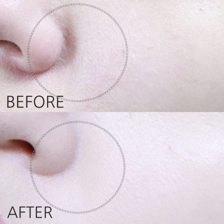 Kem dưỡng căng bóng ngừa lão hóa da Bio Heal BOH Probioderm Tightening Collagen Cream 50ml