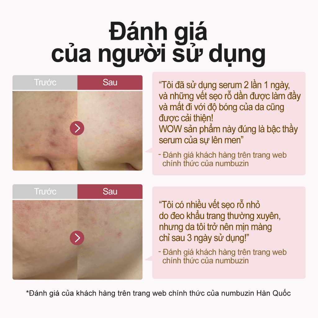 Tinh chất làm mềm da numbuzin No.3 Skin Softening Serum 50ml