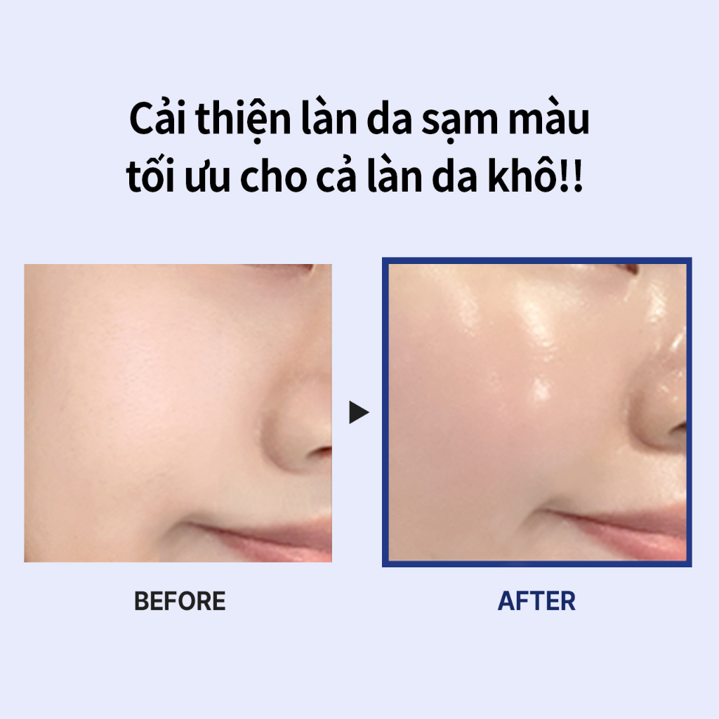 Chính Thức Của Mibipeel glutathione Thủy Thủ Kem