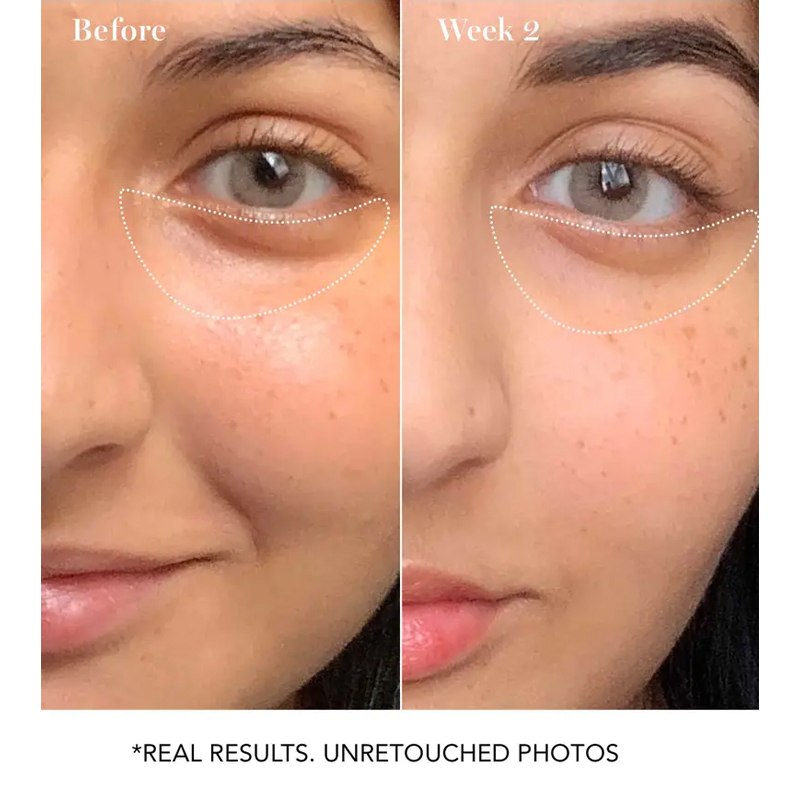 Kem Dưỡng Sáng Da Vùng Mắt Wide Awake 30ml