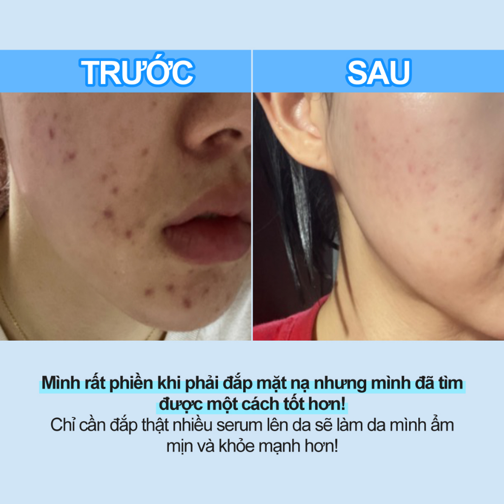 Serum numbuzin Deep Sleep mặt nạ số 6