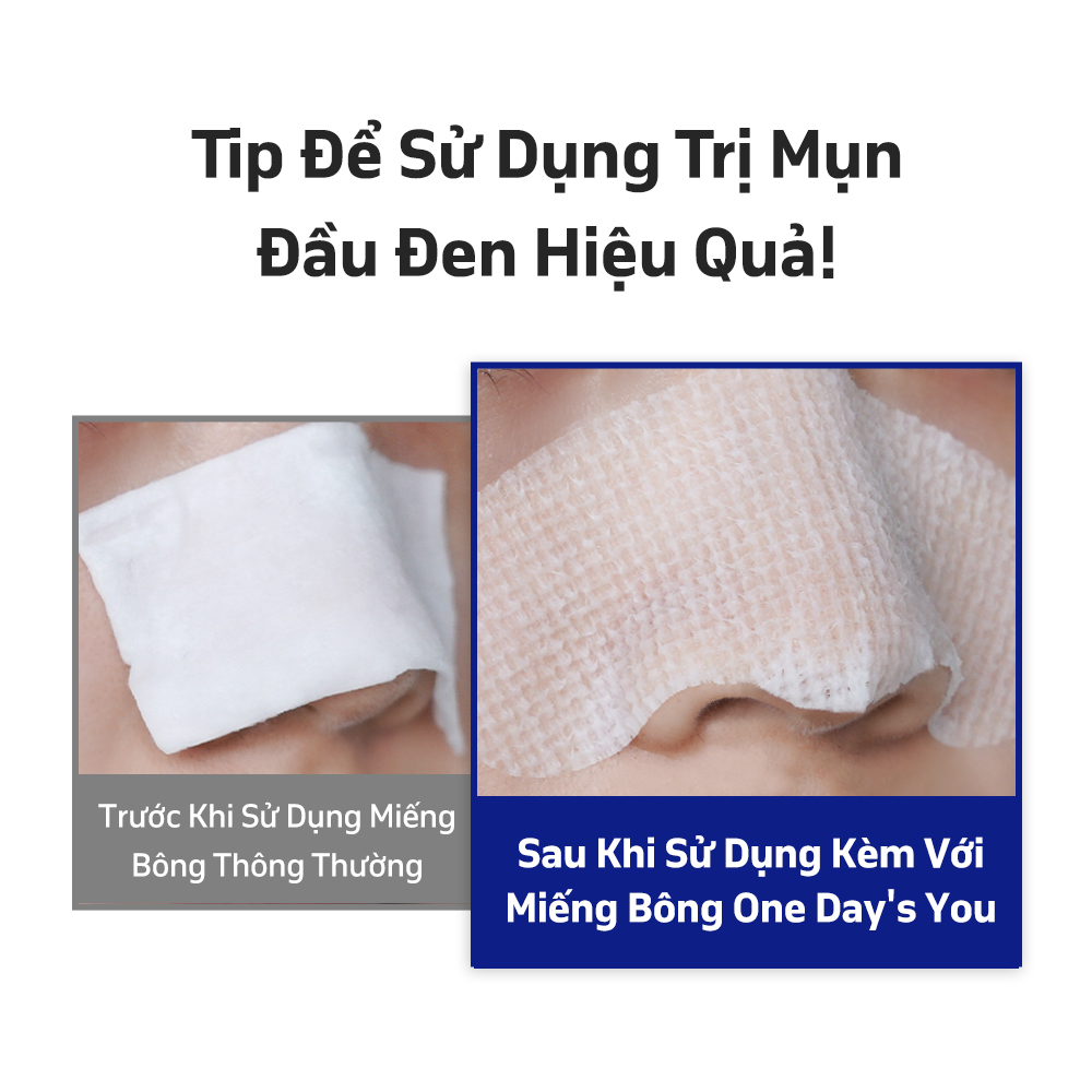 Miếng Dán ONE DAY'S YOU Lột Mụn Đầu Đen Làm Sạch Sâu Se Khít Lỗ Chân Lông (10 Miếng)