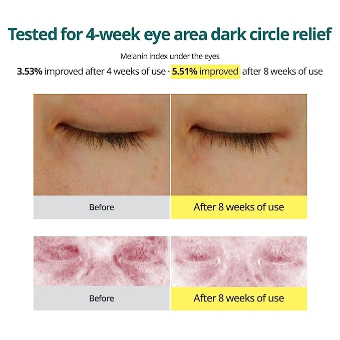 Kem Dưỡng Mắt Goodal Green Tangerine Vita C Dark Circle Eye Cream 30Ml - Giúp Giảm Quầng Thâm Chống Lão Hóa Và Nếp Nhăn