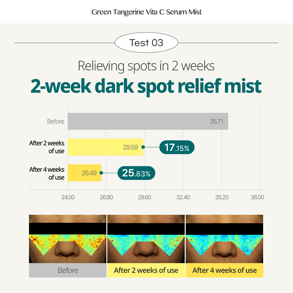 GOODAL Tinh Chất Vitamin C 100ml Dạng Xịt Giúp Làm Sáng Và Chăm Sóc Da Dầu Và Loại Bỏ Vết Thâm