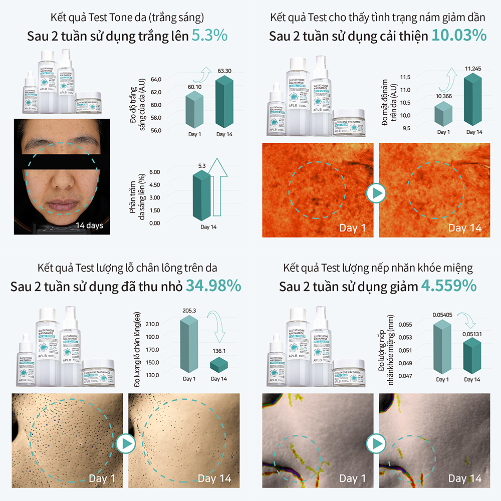 Serum Dưỡng Trắng Da Cao Cấp APLB Glutathione Niacinamide Ampoule Serum 40ml