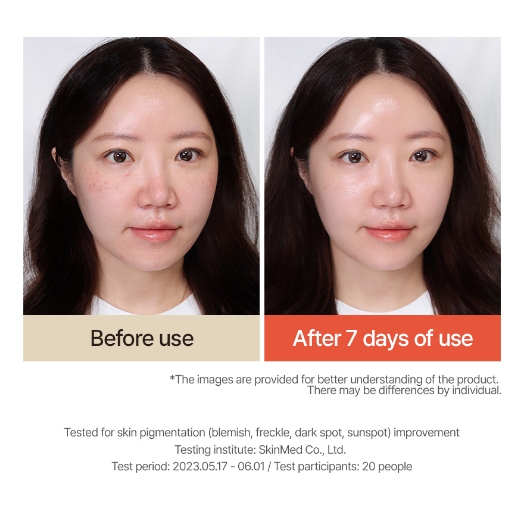 Serum niacinamide Cam Đỏ 30ml