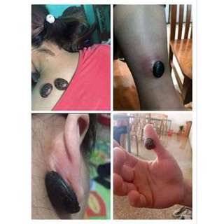 Hạt đậu hút độc(đậu lào - 12 hạt)