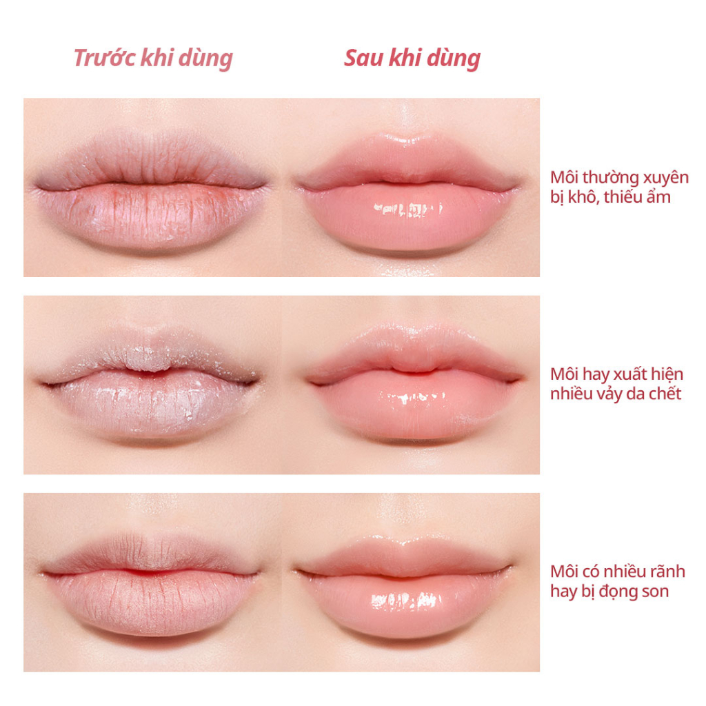 SET 4miếng mặt nạ môi dưỡng ẩm làm mềm cho đôi môi căng bóng