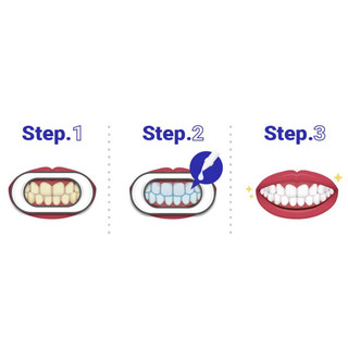 [Tooth Note] Gel làm trắng răng (2 tuần sử dụng)