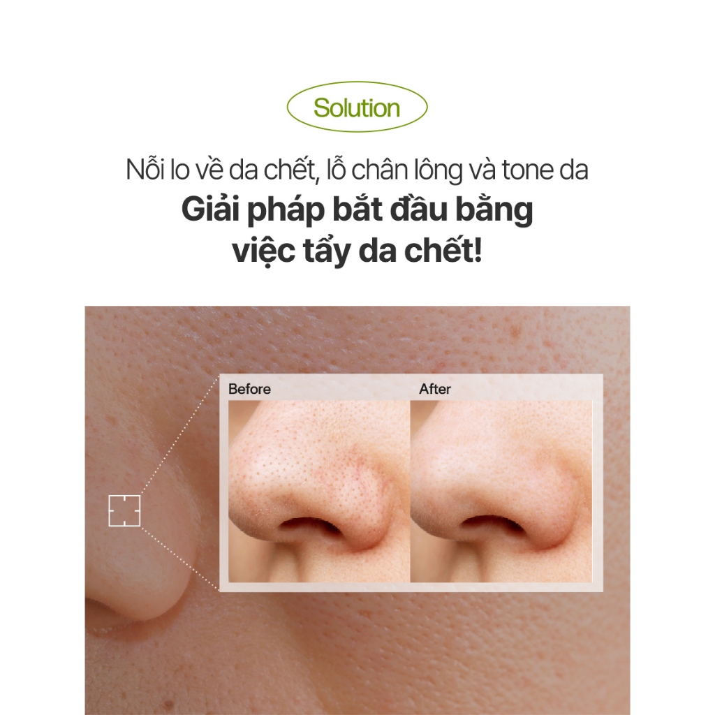 Peeling Gel cho da mặt tinh chất Quýt xanh Vita Shine trị nám se khít chân lông Bergamo 150ml