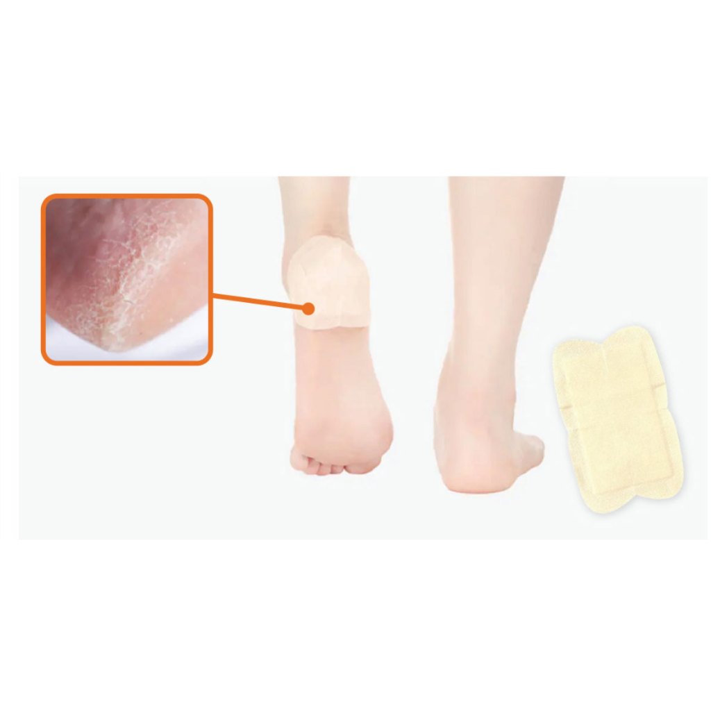 Miếng Dán Gót Mềm 4ct x 2