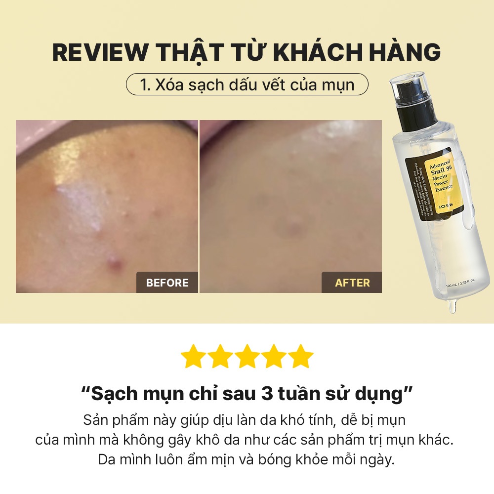 [Chỉ còn 150K sau khi áp voucher] Tinh chất ốc sên COSRX 96 Mucin 100ml hỗ trợ tái tạo dưỡng ẩm cho da